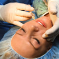 What state is the cheapest to get plastic surgery?