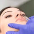 The Long-Term Effects of Nose Jobs