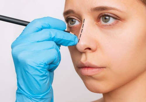 The Best Country for Rhinoplasty: Turkey or Croatia?